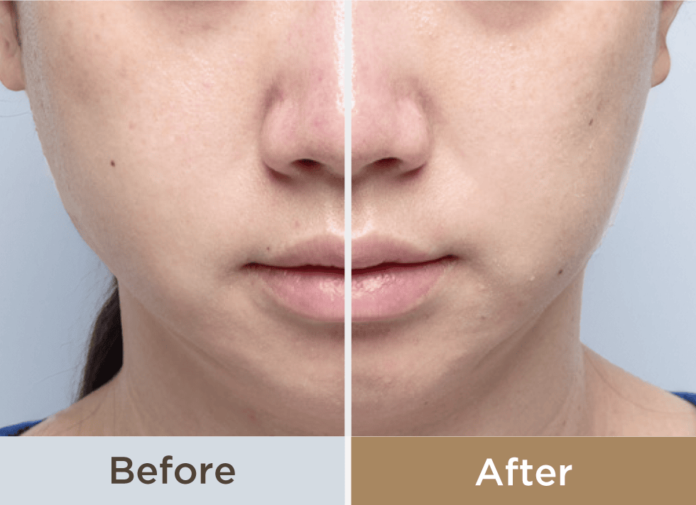 Photo PLUS Deep Lift көп функциялы премиум бет күтімі аппараты - кескін 23