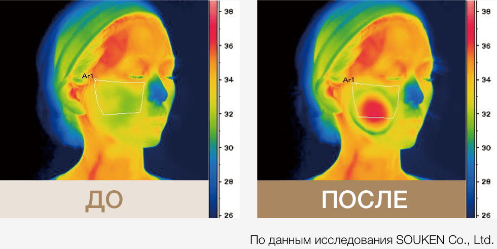 Photo PLUS Deep Lift көп функциялы премиум бет күтімі аппараты - кескін 15